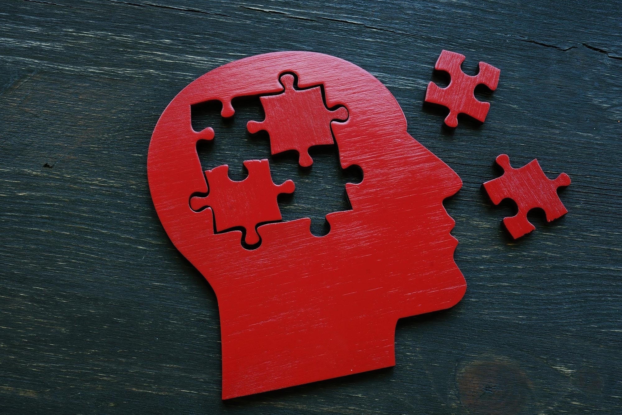 Les scientifiques identifient les protéines clés conduisant la mort des cellules cérébrales d'Alzheimer