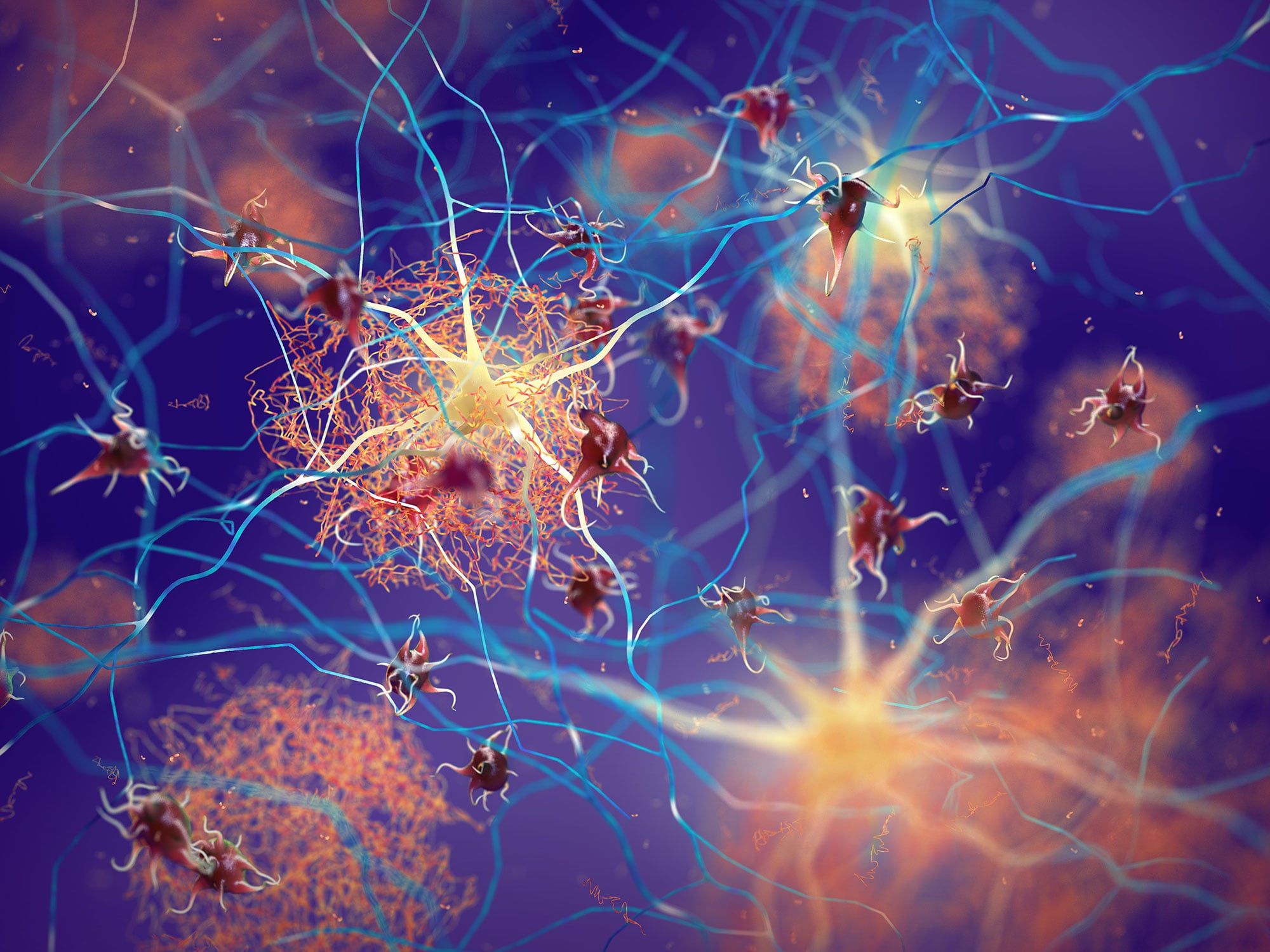 Des scientifiques découvrent une molécule naturelle qui empêche la formation d’amas de protéines dans la maladie d’Alzheimer