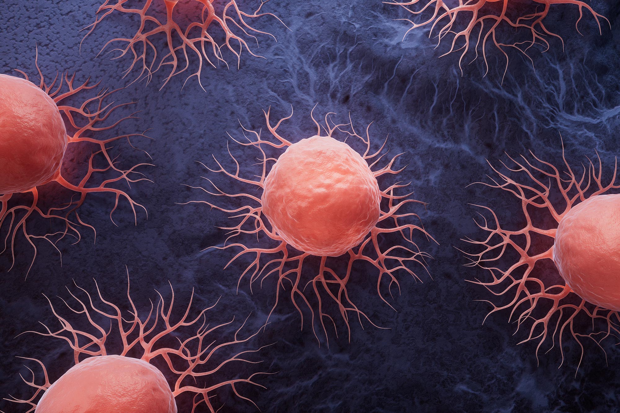 Les chercheurs découvrent l'arme secrète du cancer contre les cellules immunitaires