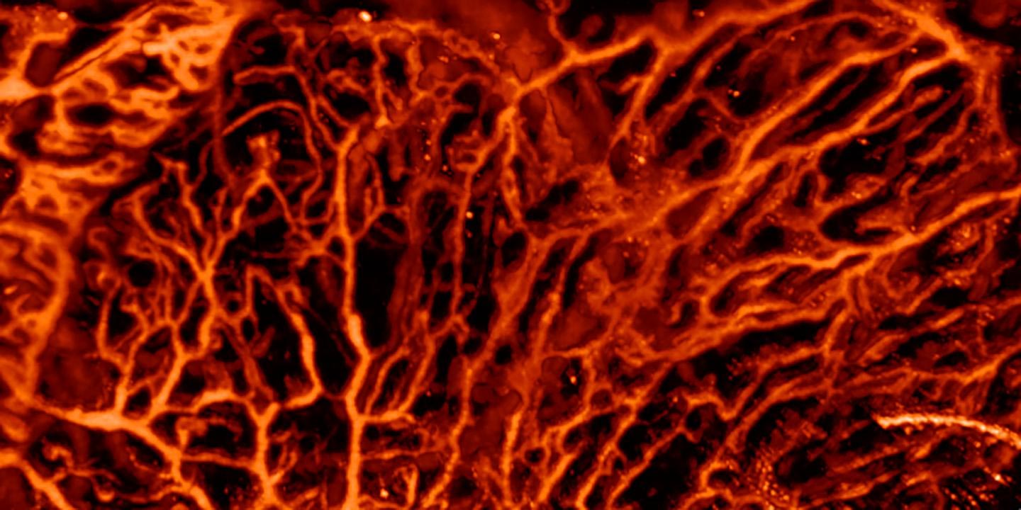 L'intelligence artificielle améliore l'imagerie biomédicale