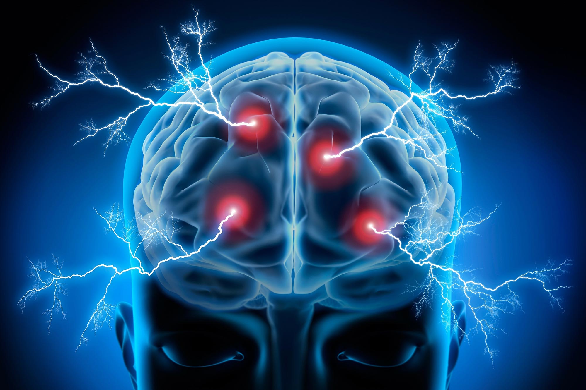 Étude: une méthode simple de stimulation cérébrale pourrait accélérer la prise de décision