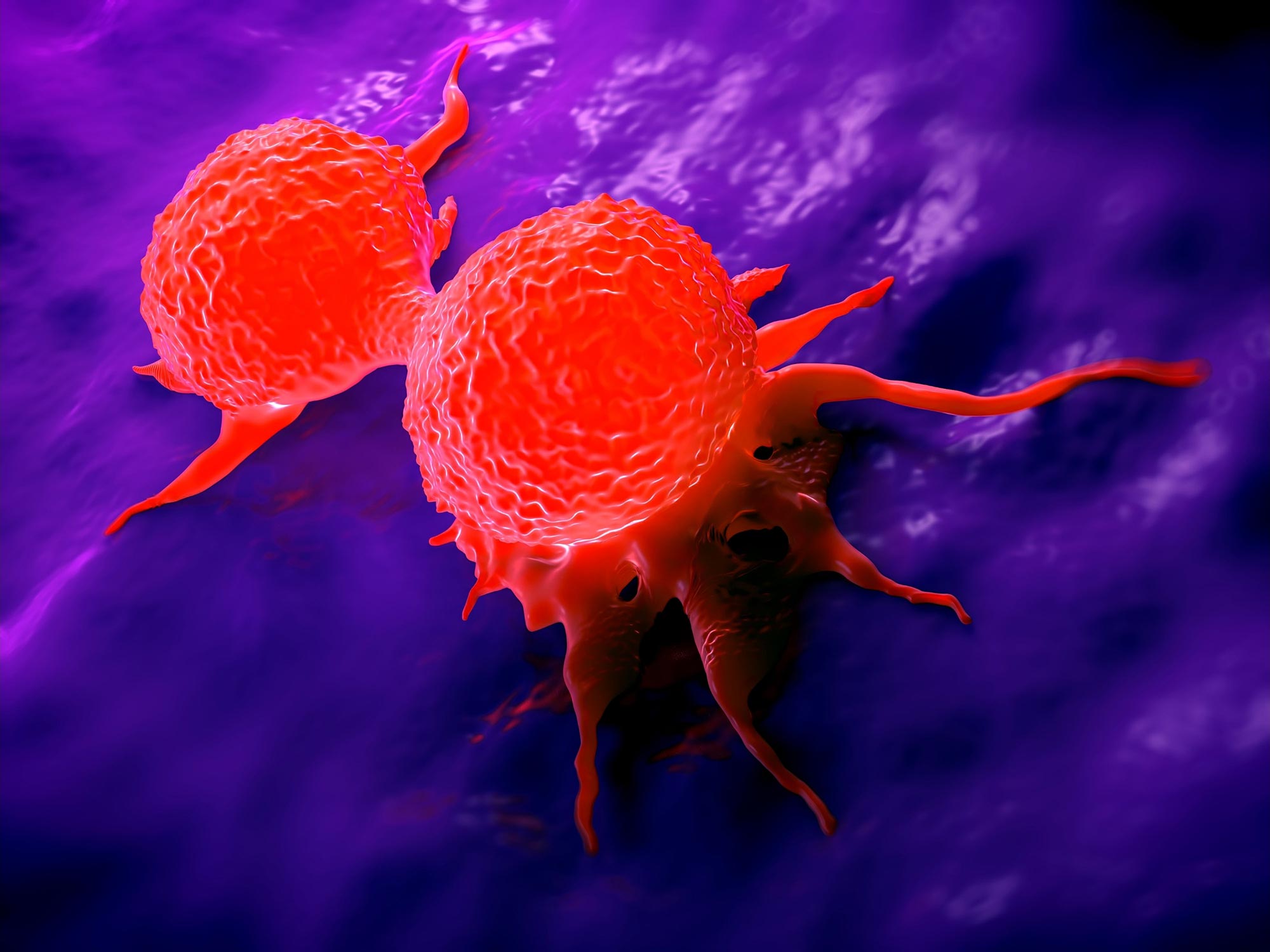 Juste un petit nombre de cellules dans une tumeur peuvent permettre au cancer de se propager à d'autres parties du corps