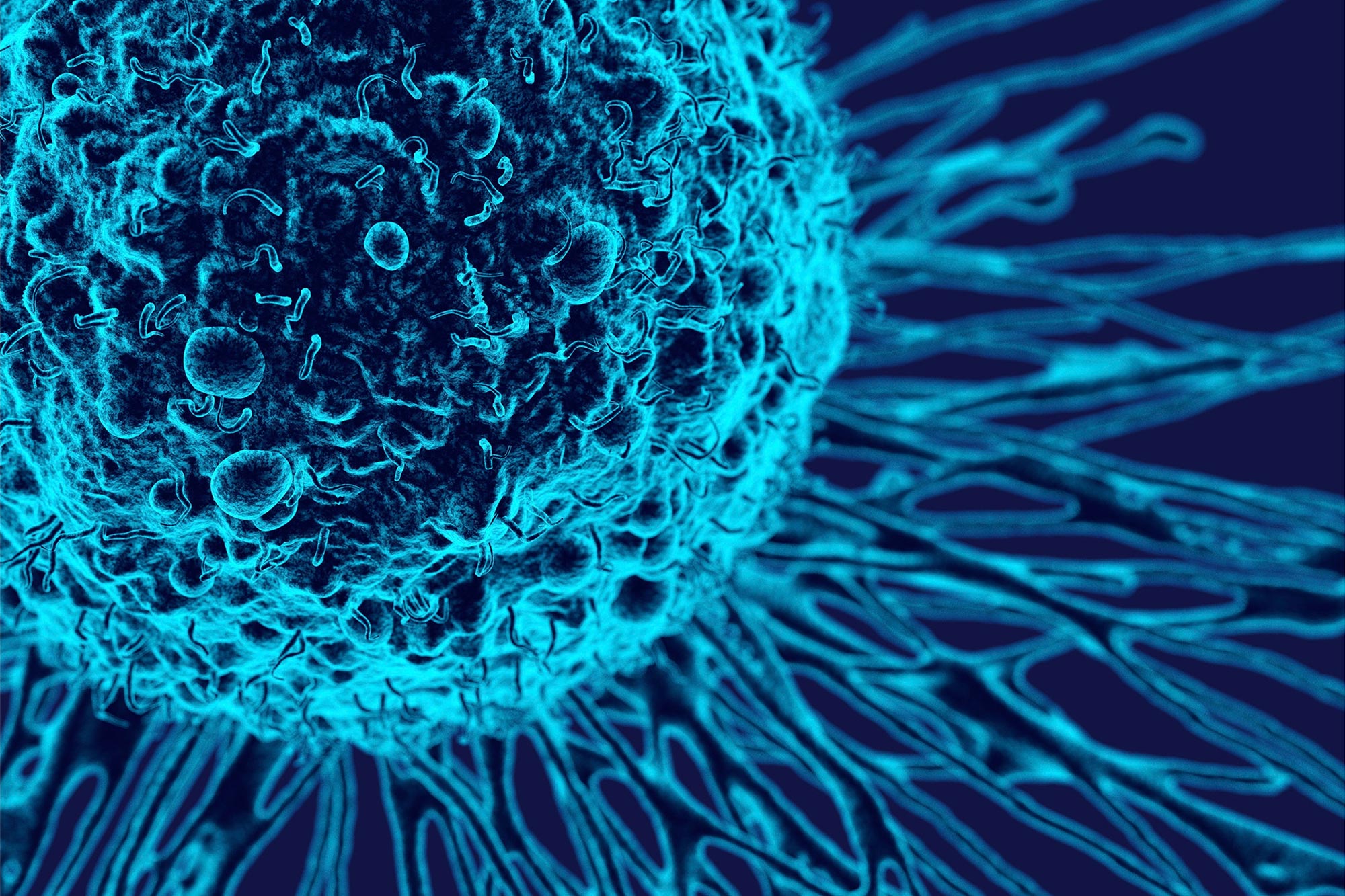 Prothrough Prot Therapy essuie un cancer rare sans effets secondaires