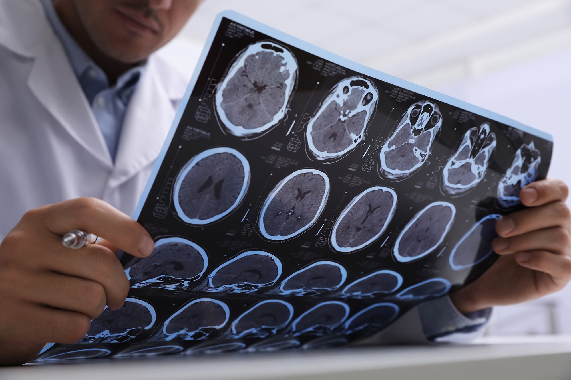 Une nouvelle avancée en IRM capture des images incroyablement claires de l’œil et du cerveau
