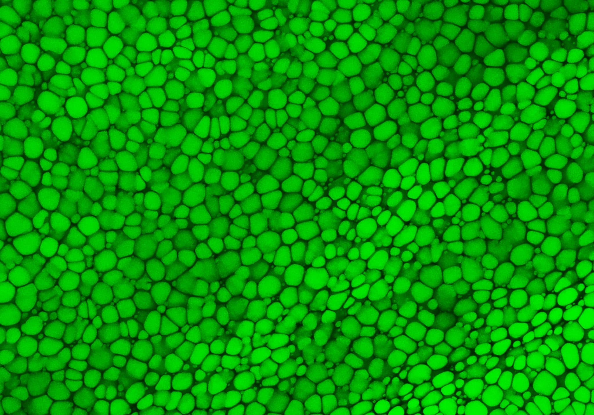 Répartir des hypothèses de longue date: les scientifiques ont découvert un nouveau type de tissu squelettique