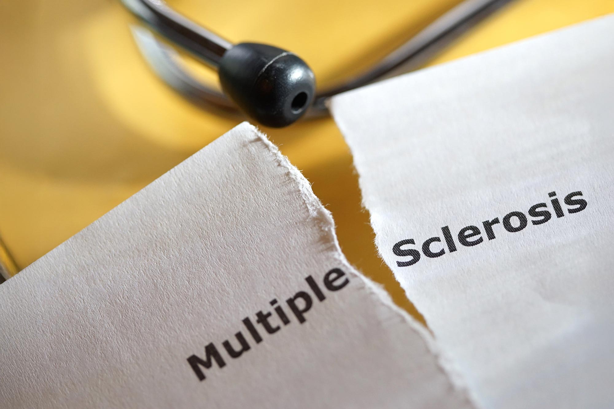 Des lésions cérébrales cachées découvertes des années avant le diagnostic de SEP