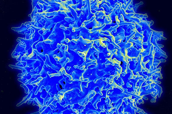 Une nouvelle forme d'immunothérapie prometteuse pour le cancer
