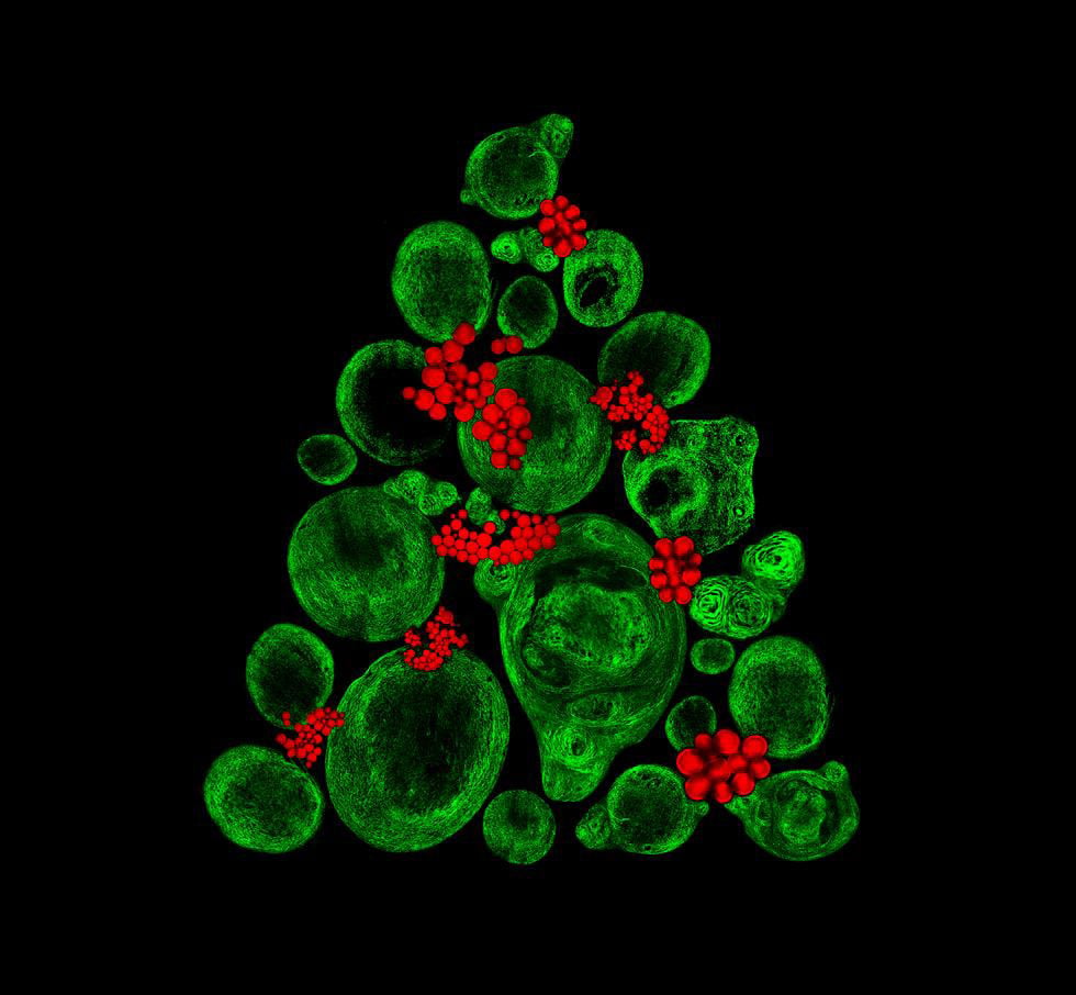 Les images saisonnières améliorées par les couleurs révèlent la science derrière les cellules souches