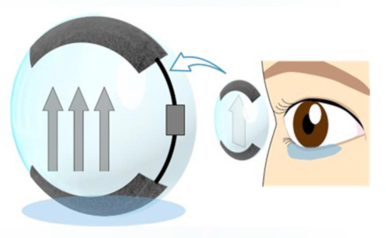 Lentilles de contact intelligentes auto-horrises 