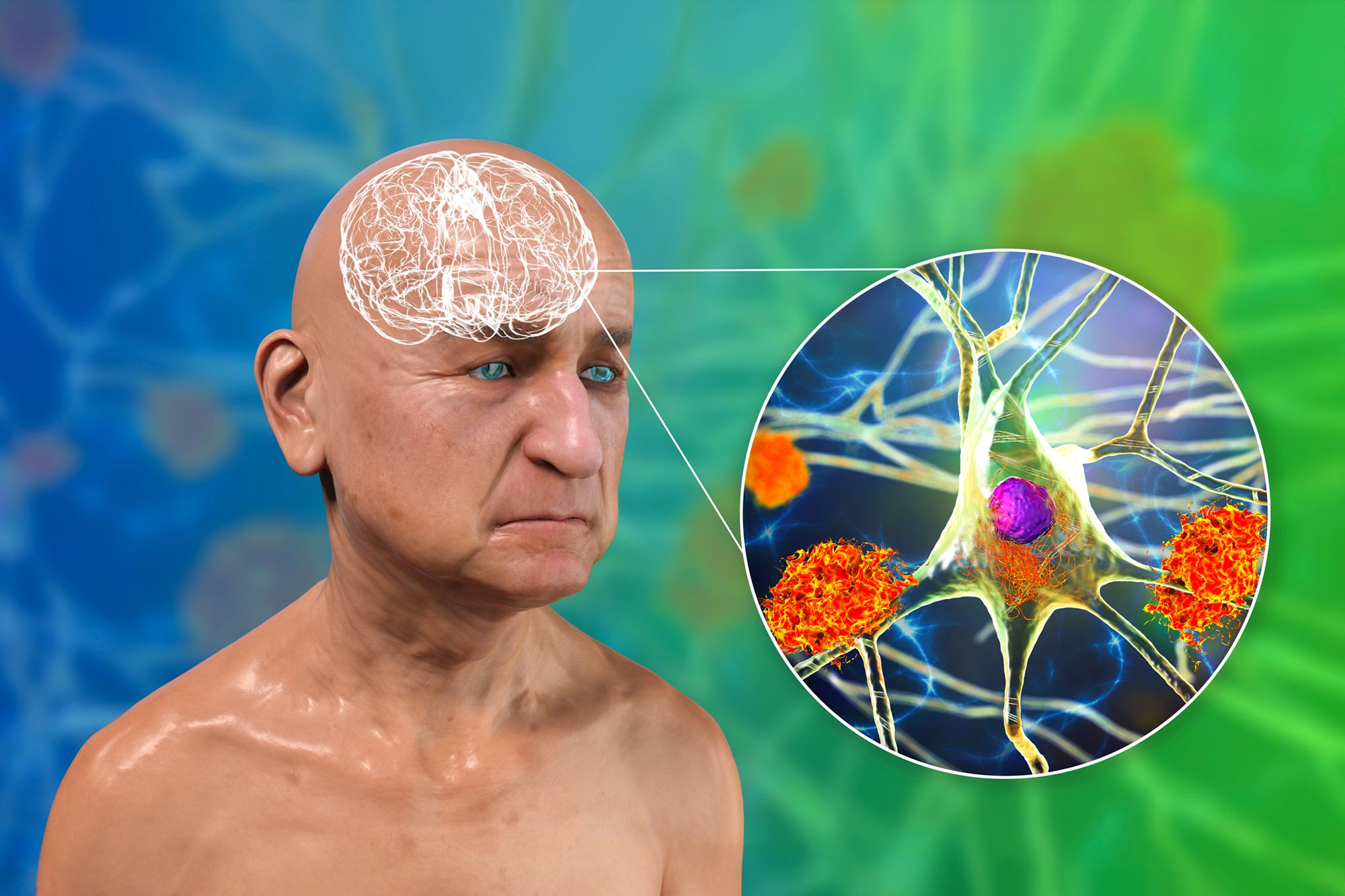 Une nouvelle étude remet en question des décennies de compréhension de la maladie d’Alzheimer grâce à la découverte de microtubules