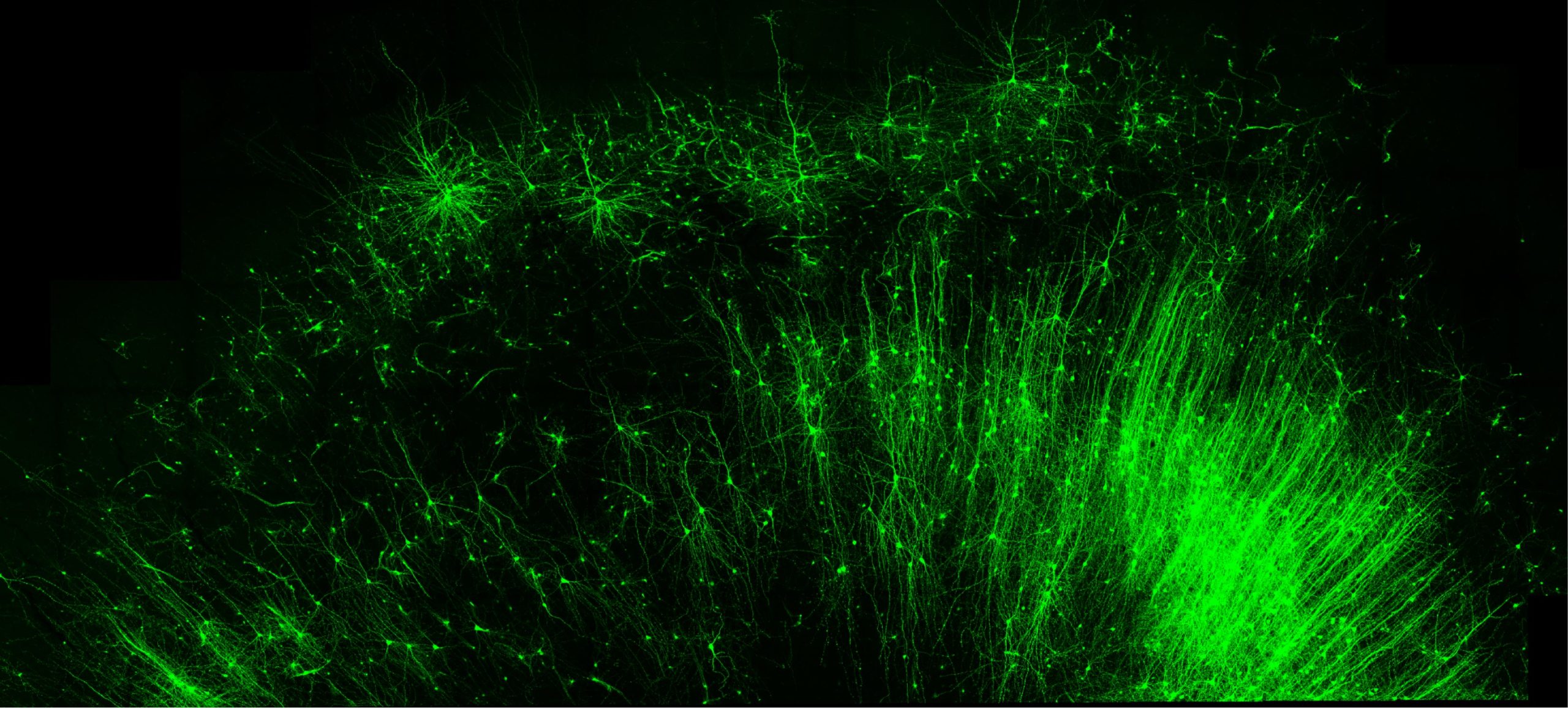 Un nouvel outil d'ARN peut éclairer les circuits cérébraux et éditer des cellules spécifiques