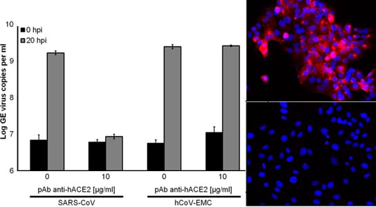 Nouveau coronavirus HCOV-EMC infecte les humains et les animaux