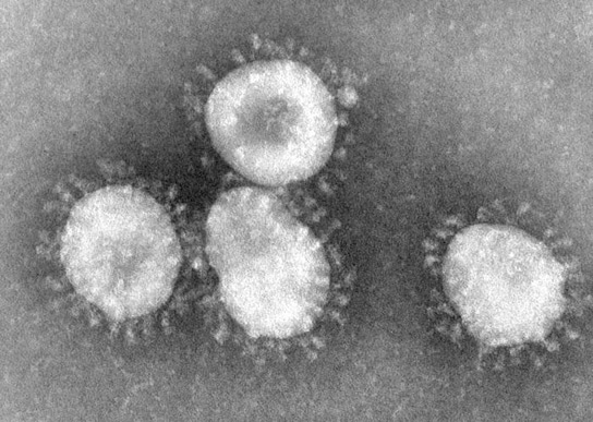 Le nouveau coronavirus pourrait infecter des millions de personnes au Hajj en Arabie saoudite