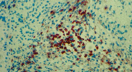 Les revendications de transplantation de cellules de cellules de Hisashi Moriguchi ont réfutées